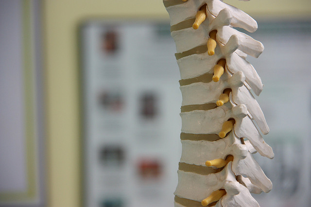 World’s First 3D Printed Vertebrae