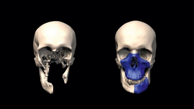 3d print skull