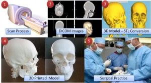 CT MRI Scan DICOM Images to 3D Printed Models