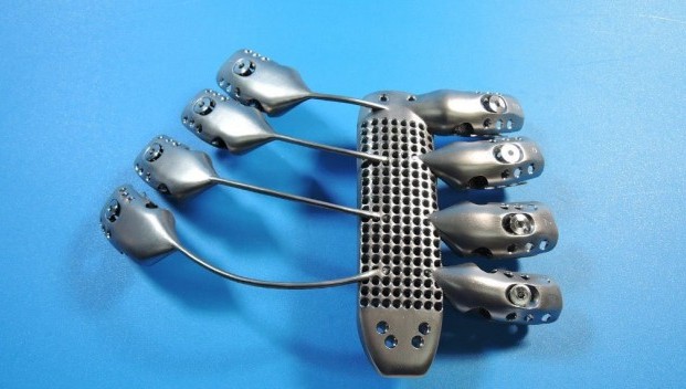 World first 3D printed rib cage