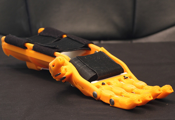 A 6 year old boy gets 3D printed bionic hand