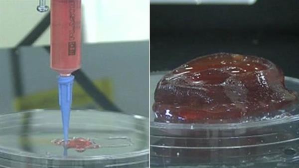 Researchers 3D print cartilage that can be used for ear and nose transplants