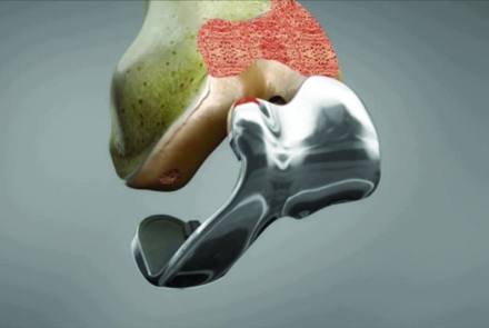Surgical