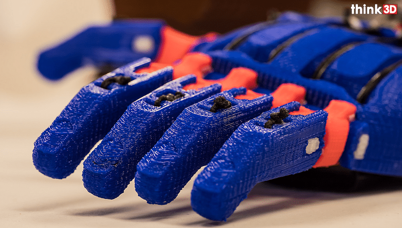 3D Printed Custom Prosthetics