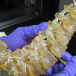 3D Printed Models For Surgical Planning