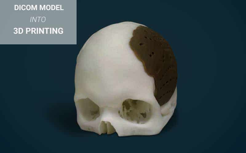 Skull-copy-1